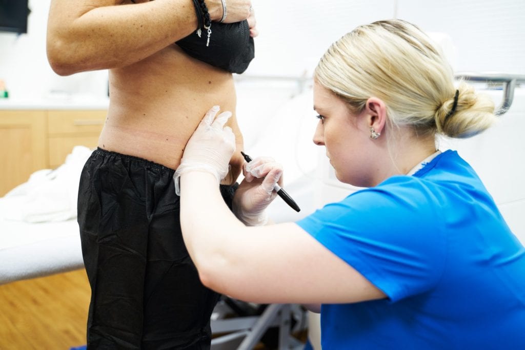 CoolSculpting